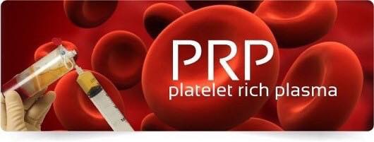 Tocolo, Platelet Rich Plasma (PRP) 0725 