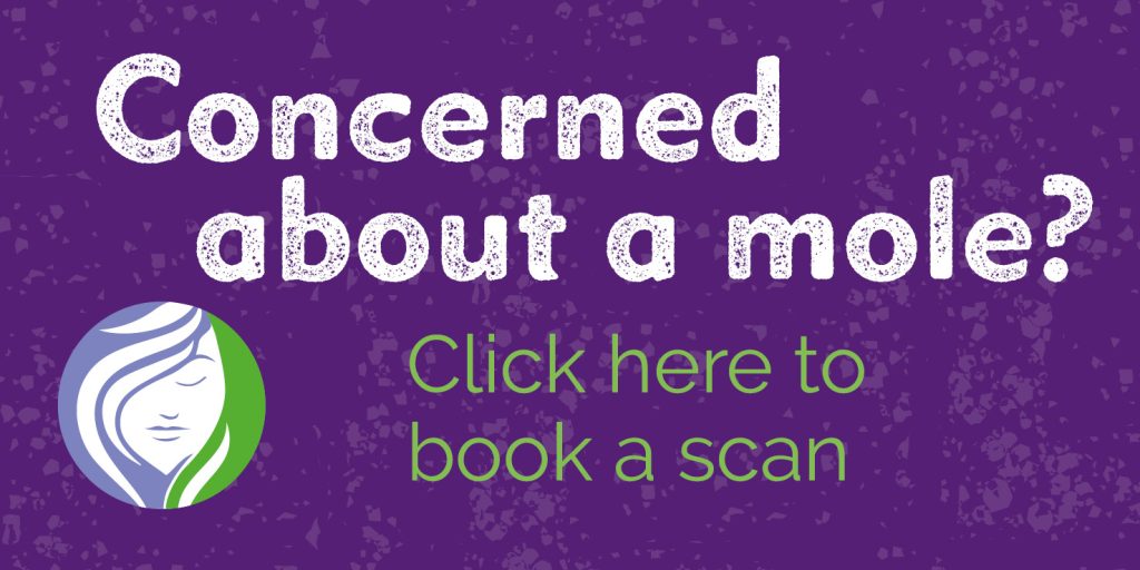 Concerned about a mole? Click here to book a scan